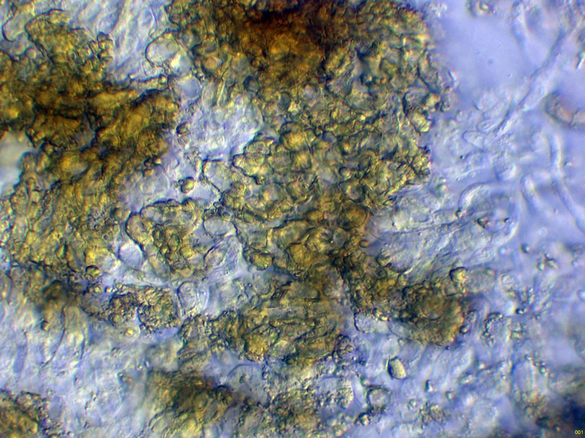 10 - Excípulo externo-001